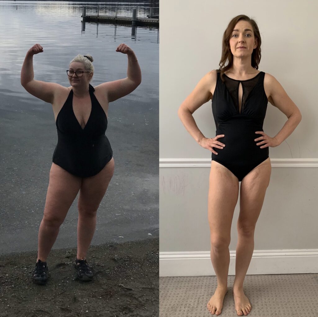 GLP-1 weight loss journey